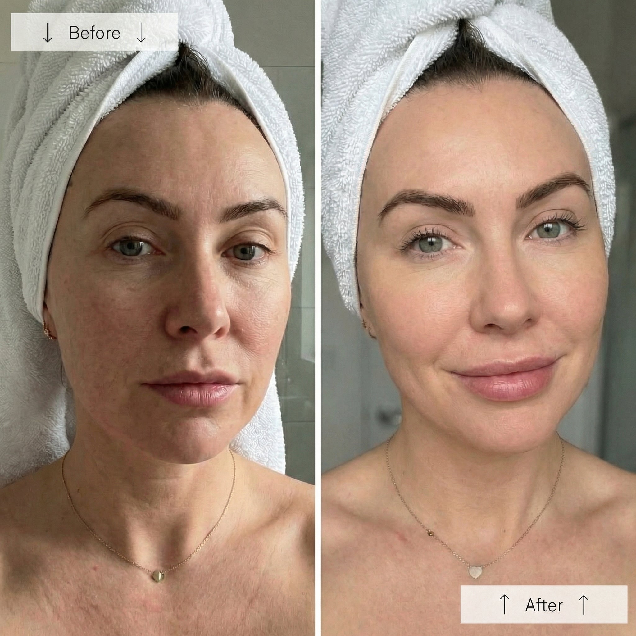IONBOOST+ SKIN ABSORPTION BOOSTER